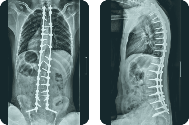 neuromuscular